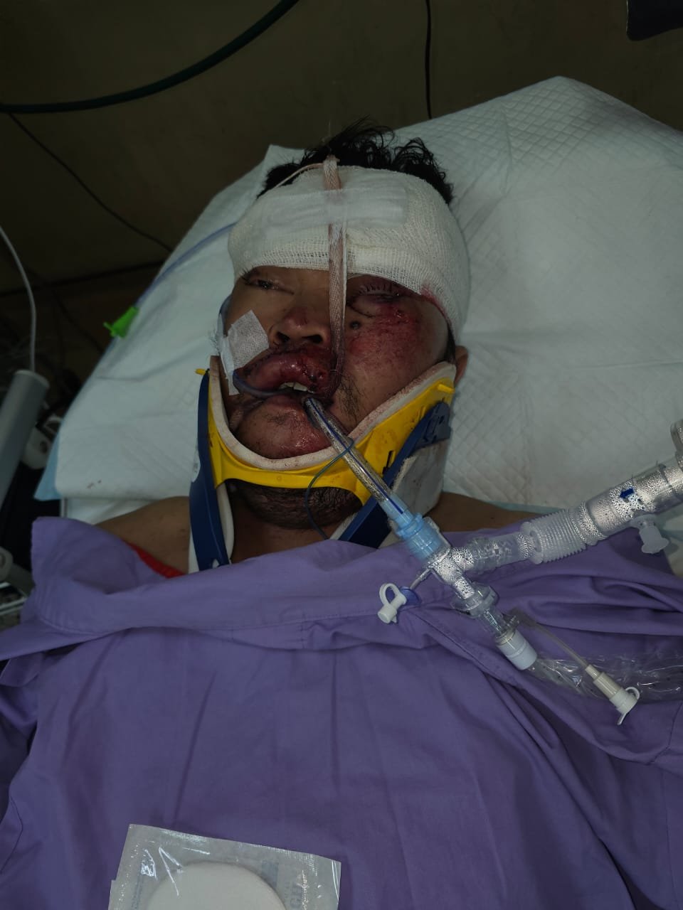 IMiwan Putra Warga Talang Leak Korban Lakanlantas Di Malaysia